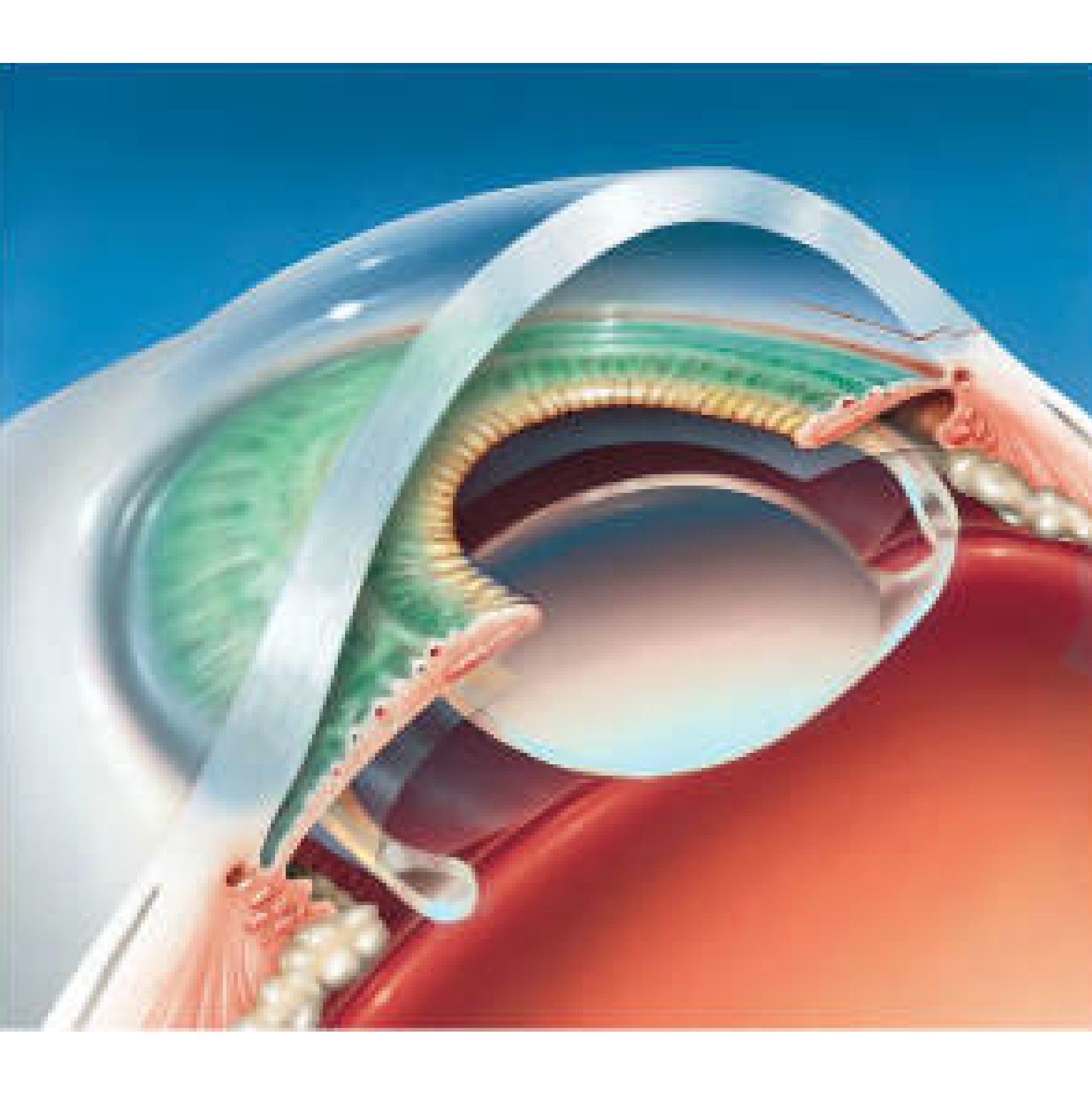 09-Steps-of-surgery1-sm-03